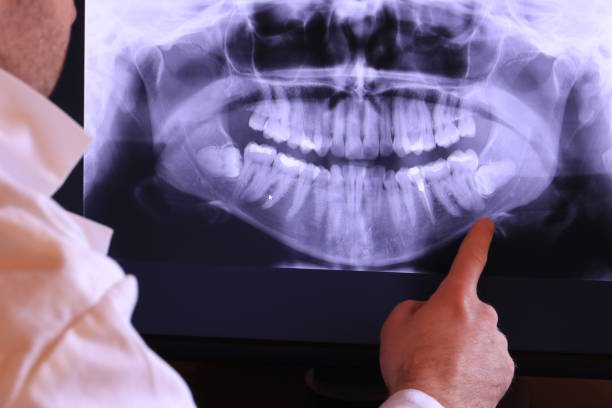 Best Emergency Broken Tooth Repair in Wolf Point, MT