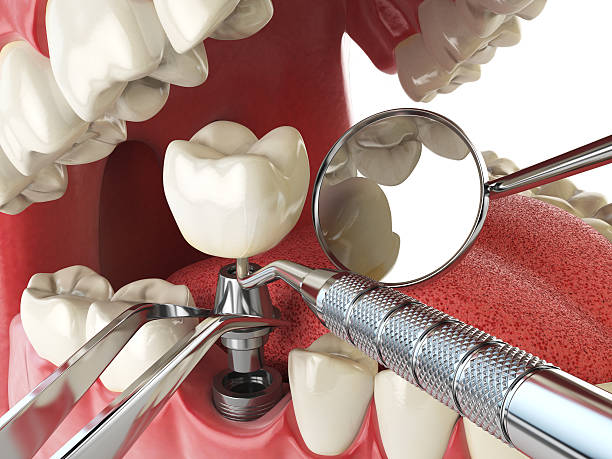 Best Emergency Treatment for Toothache in Wolf Point, MT